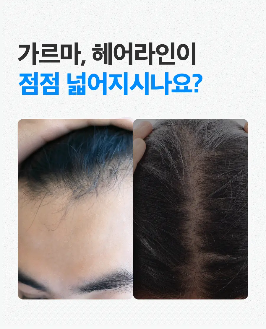 [올영단독/더블기획] 씨퓨리 닥터33 탈모앰플 20ml + 20ml 더블 기획세트 상세페이지 18